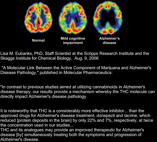 Click image for larger version

Name:	alzheimer.png
Views:	1
Size:	218.6 KB
ID:	523